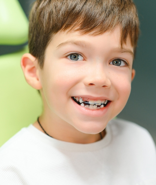 img-trmt-dentofacial-01a