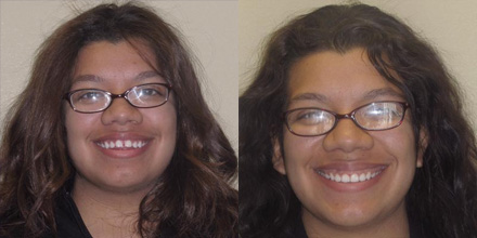 img-patient-before-and-after
