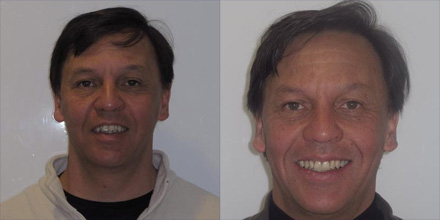 img-patient-before-and-after