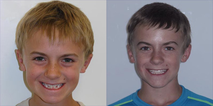 img-patient-before-and-after