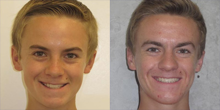 img-patient-before-and-after